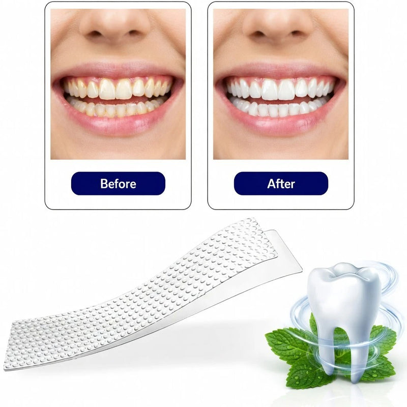 Before and after FlashSmile whitening strips