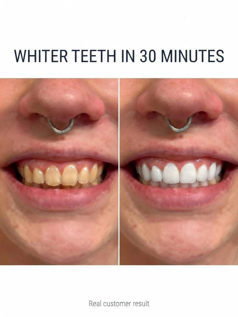 Real customer before and after