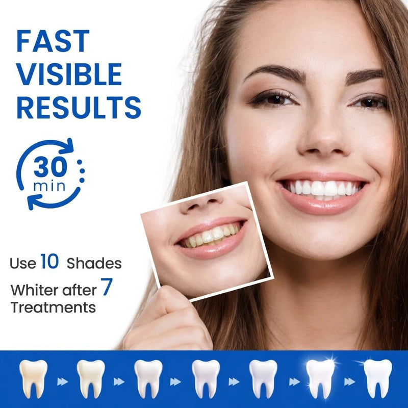 Applying FlashSmile strip